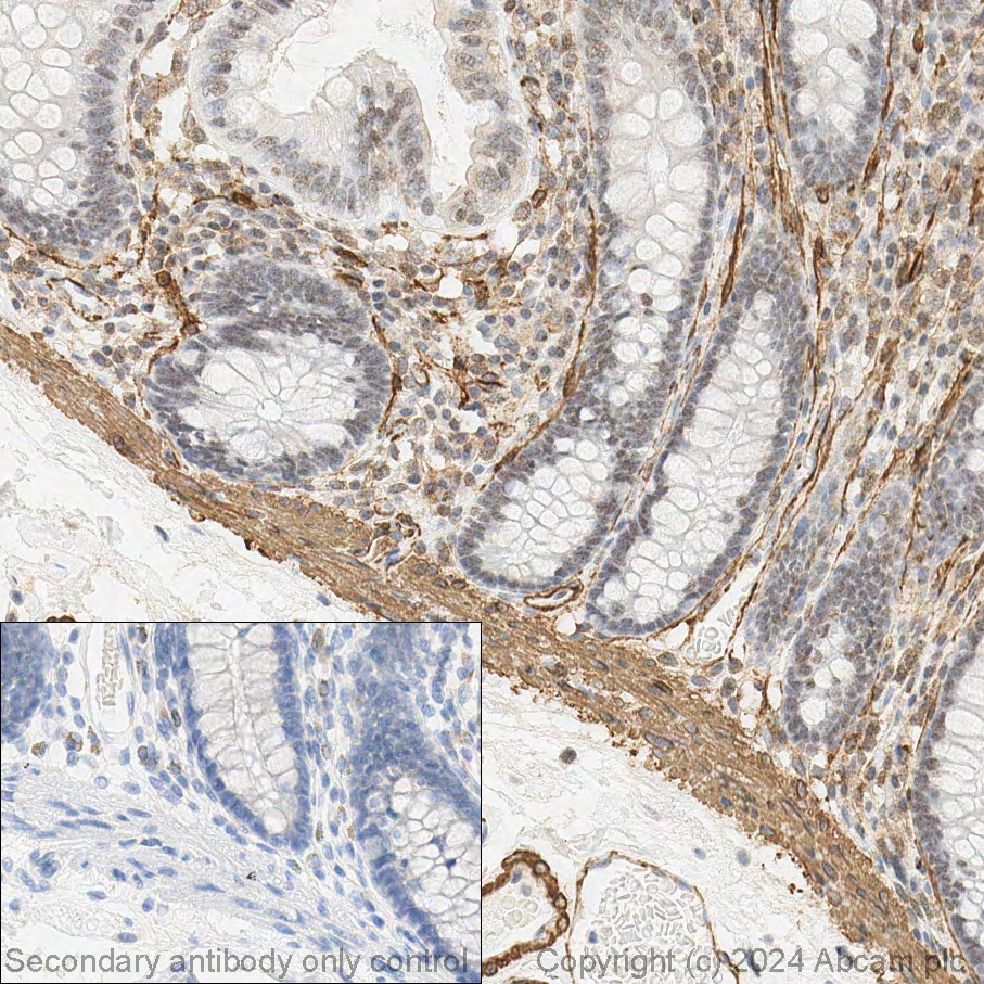 Immunohistochemistry (Formalin/PFA-fixed paraffin-embedded sections) - Biotin Anti-alpha smooth muscle Actin antibody [1A4] (AB125057), expandable thumbnail