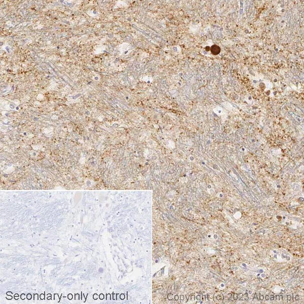 Immunohistochemistry (Formalin/PFA-fixed paraffin-embedded sections) - Biotin Anti-Alpha-synuclein antibody [MJFR1] (AB309388)