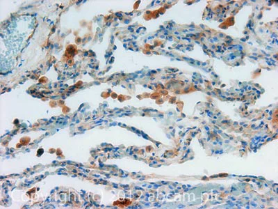 Immunohistochemistry (Formalin/PFA-fixed paraffin-embedded sections) - Biotin Anti-beta 2 Microglobulin antibody [B2M-01] (AB21899)