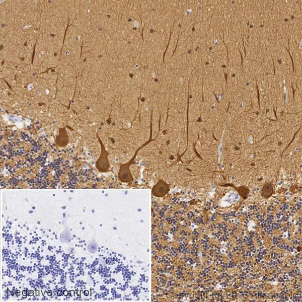 Immunohistochemistry (Formalin/PFA-fixed paraffin-embedded sections) - Biotin Anti-beta III Tubulin antibody [EP1569Y] - Neuronal Marker (AB195903)