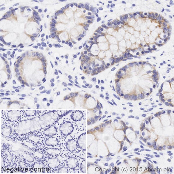 Immunohistochemistry (Formalin/PFA-fixed paraffin-embedded sections) - Biotin Anti-BMP4 antibody [EPR6211] (AB202525), expandable thumbnail