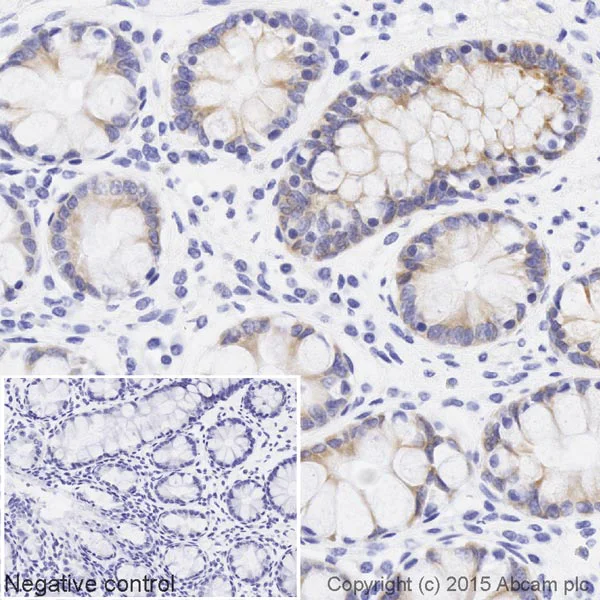 Immunohistochemistry (Formalin/PFA-fixed paraffin-embedded sections) - Biotin Anti-BMP4 antibody [EPR6211] (AB202525)