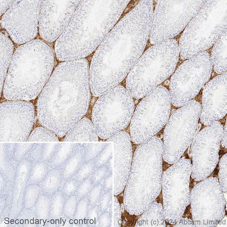 Immunohistochemistry (Formalin/PFA-fixed paraffin-embedded sections) - Biotin Anti-C3/C3b antibody [EPR19394] (AB322300)