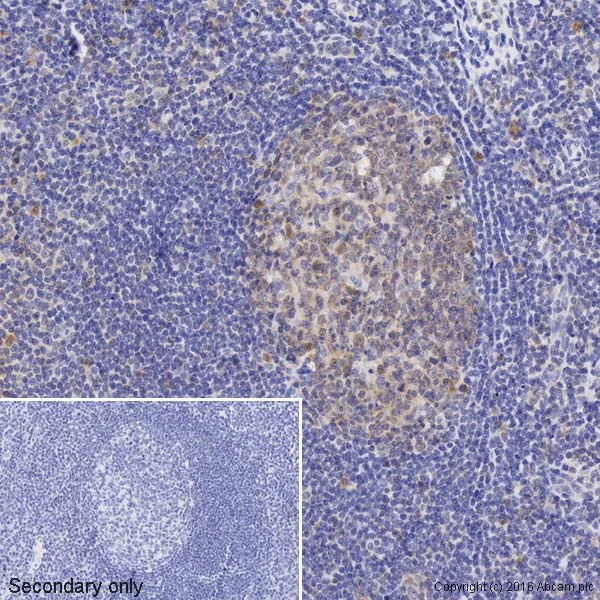 Immunohistochemistry (Formalin/PFA-fixed paraffin-embedded sections) - Biotin Anti-Caspase-3 antibody [E87] (AB195905)