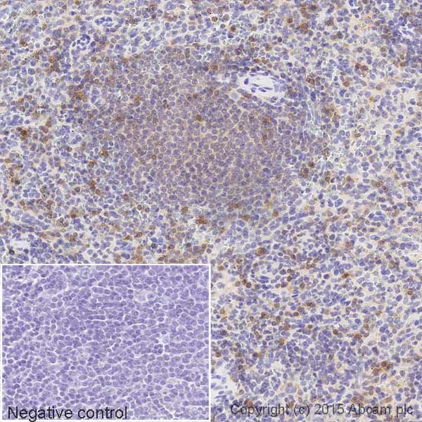 Immunohistochemistry (Formalin/PFA-fixed paraffin-embedded sections) - Biotin Anti-CD11a antibody [EP1285Y] (AB200022)
