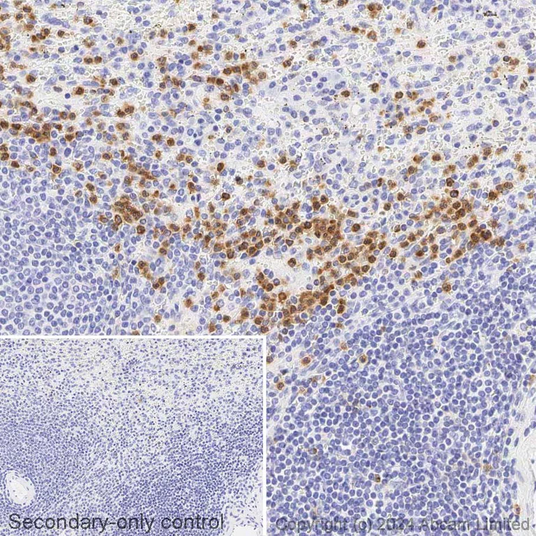 Immunohistochemistry (Formalin/PFA-fixed paraffin-embedded sections) - Biotin Anti-CD11b antibody [EPR1344] (AB322298)