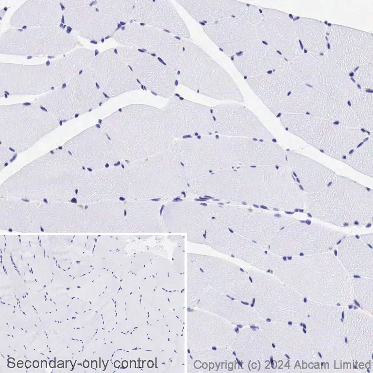 Immunohistochemistry (Formalin/PFA-fixed paraffin-embedded sections) - Biotin Anti-CD11b antibody [EPR1344] (AB322298)