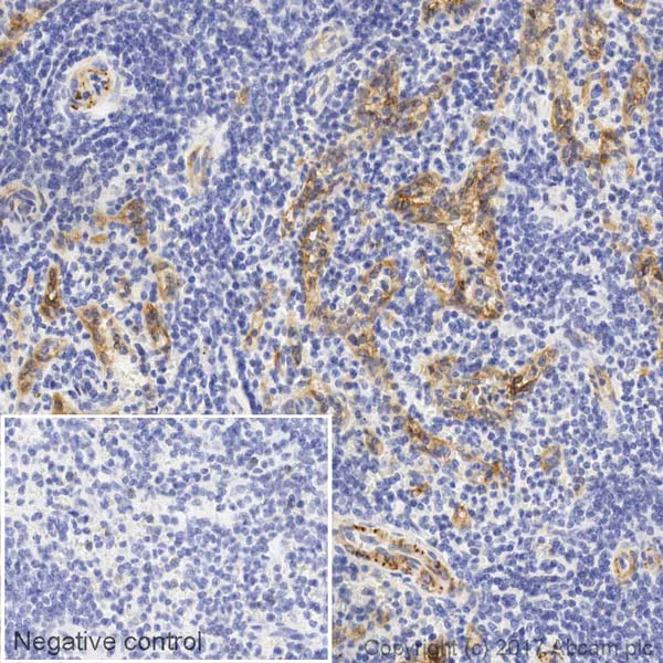 Immunohistochemistry (Formalin/PFA-fixed paraffin-embedded sections) - Biotin Anti-CD146 antibody [EPR3208] (AB217072)