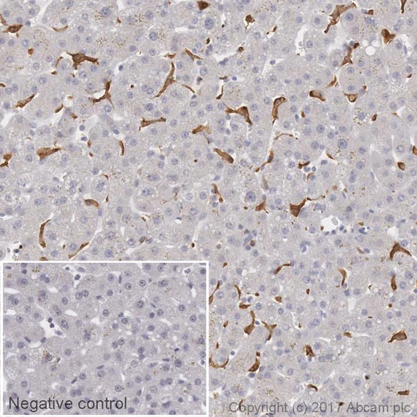 Immunohistochemistry (Formalin/PFA-fixed paraffin-embedded sections) - Biotin Anti-CD163 antibody [EPR14643-36] - C-terminal (AB218295)