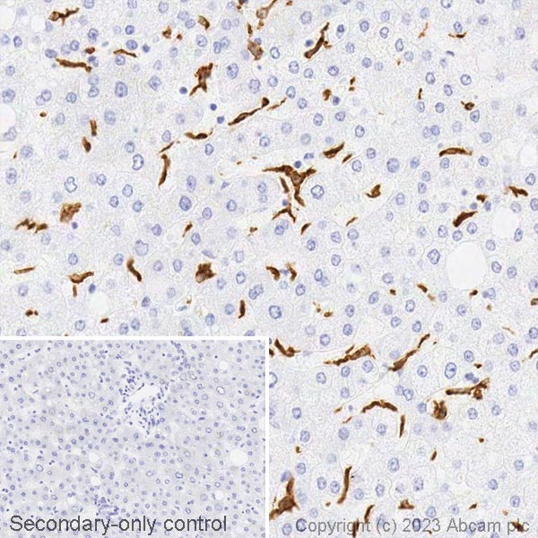 Immunohistochemistry (Formalin/PFA-fixed paraffin-embedded sections) - Biotin Anti-CD163 antibody [EPR19518] (AB314941), expandable thumbnail
