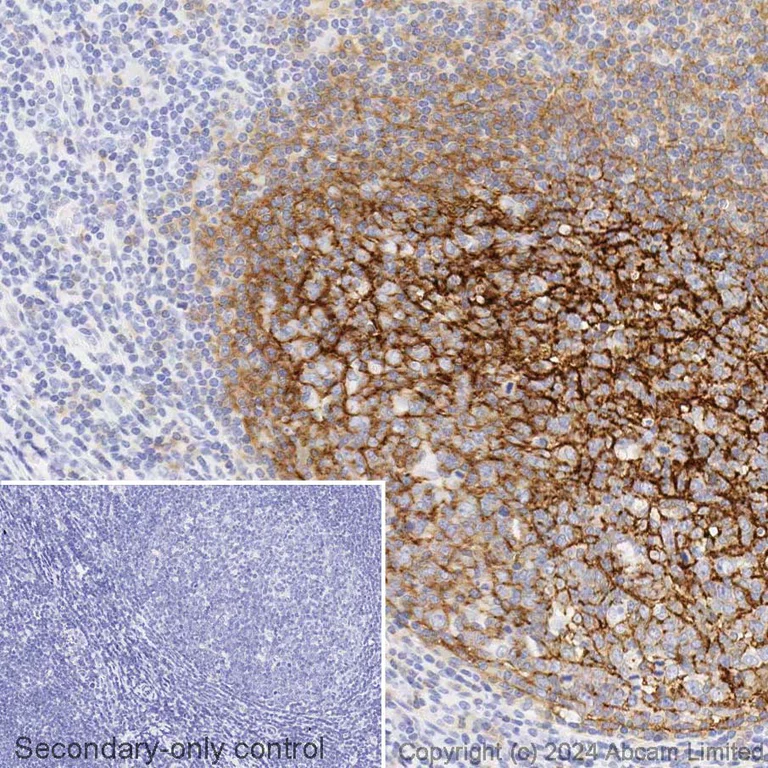 Immunohistochemistry (Formalin/PFA-fixed paraffin-embedded sections) - Biotin Anti-CD21 antibody [EP3093] (AB322303)