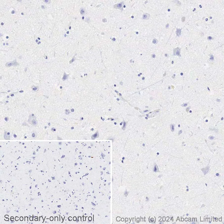 Immunohistochemistry (Formalin/PFA-fixed paraffin-embedded sections) - Biotin Anti-CD21 antibody [EP3093] (AB322303)