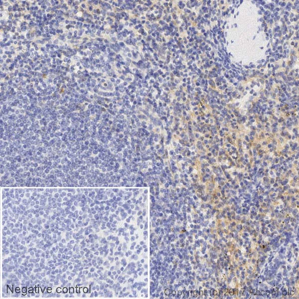 Immunohistochemistry (Formalin/PFA-fixed paraffin-embedded sections) - Biotin Anti-CD31 antibody [EPR3094] (AB199734)