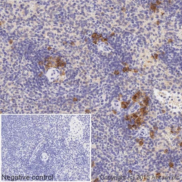 Immunohistochemistry (Formalin/PFA-fixed paraffin-embedded sections) - Biotin Anti-CD38 antibody [EPR4106] (AB201498)
