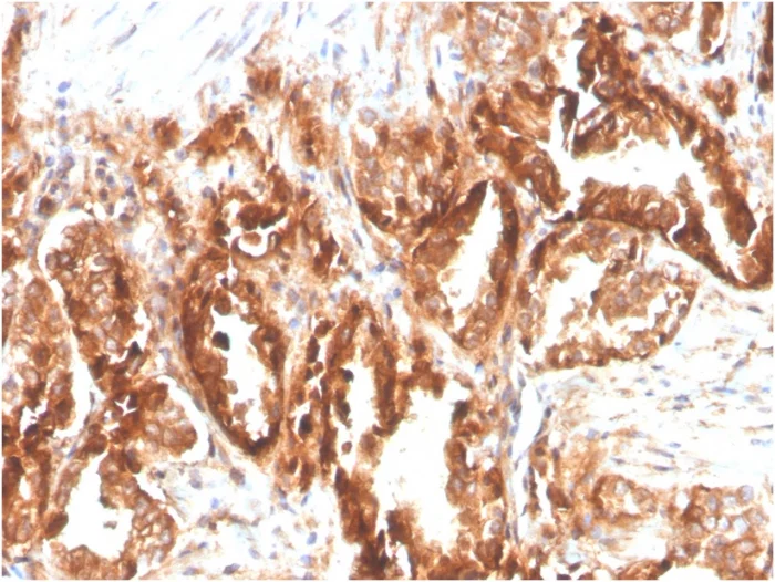 Immunohistochemistry (Formalin/PFA-fixed paraffin-embedded sections) - Biotin Anti-CD47 antibody [CD47/2937] (AB271823)