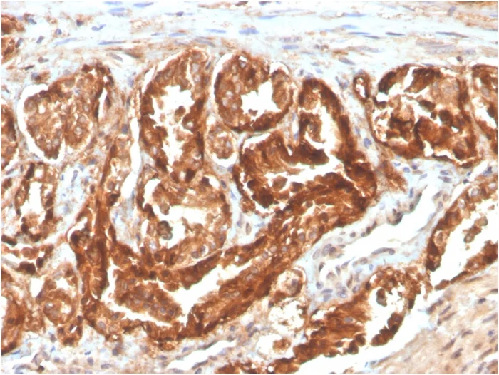 Immunohistochemistry (Formalin/PFA-fixed paraffin-embedded sections) - Biotin Anti-CD47 antibody [CD47/2937] (AB271823)