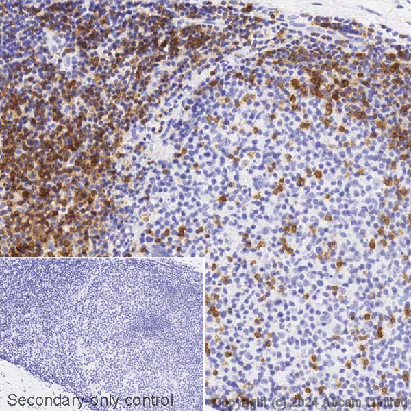 Immunohistochemistry (Formalin/PFA-fixed paraffin-embedded sections) - Biotin Anti-CD5 [SP19] (AB318315)