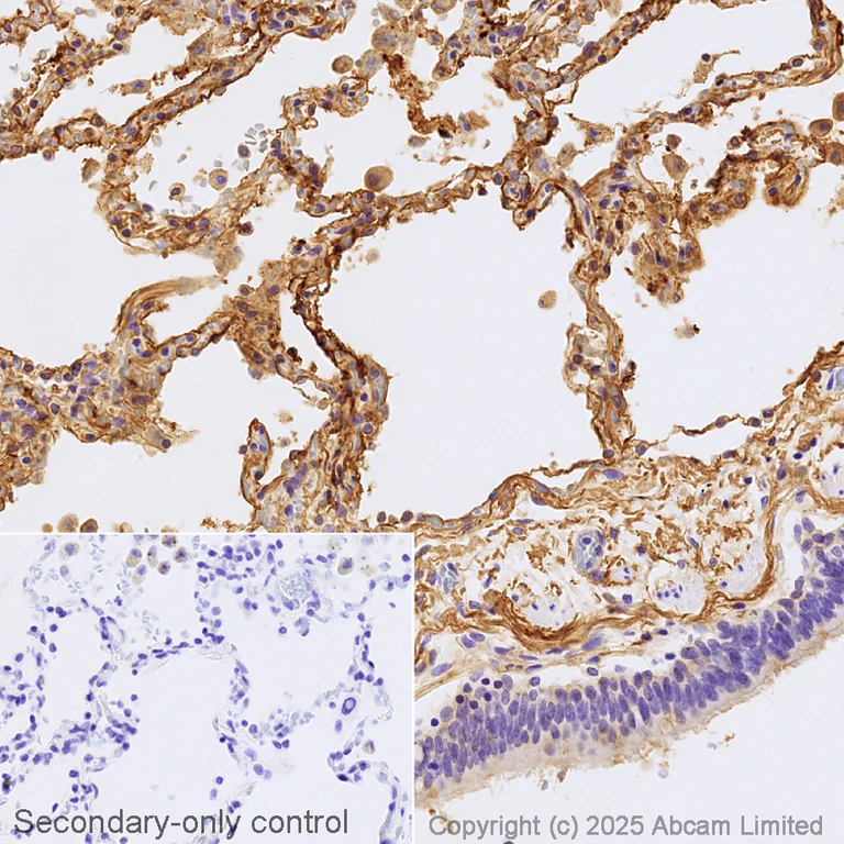 Immunohistochemistry (Formalin/PFA-fixed paraffin-embedded sections) - Biotin Anti-CD55 antibody [EPR6689] (AB323679)