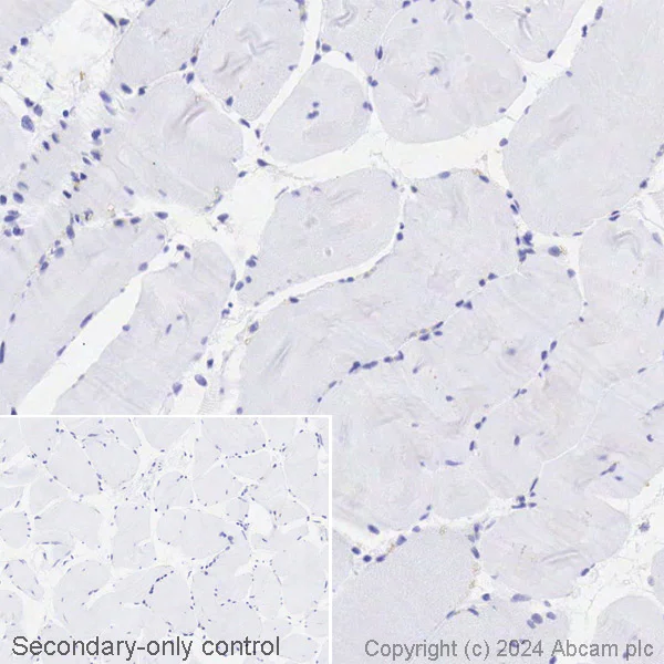 Immunohistochemistry (Formalin/PFA-fixed paraffin-embedded sections) - Biotin Anti-CD63 antibody [EPR5702] - Late Endosome Marker (AB316180)