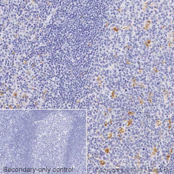 Immunohistochemistry (Formalin/PFA-fixed paraffin-embedded sections) - Biotin Anti-CD68 antibody [KP1] (AB317601), expandable thumbnail