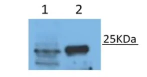 Western blot - Biotin Anti-CD9 antibody [A1501] (AB286172)