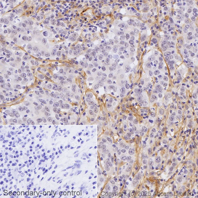 Immunohistochemistry (Formalin/PFA-fixed paraffin-embedded sections) - Biotin Anti-CD90 / Thy1 antibody [EPR3132] (AB323685)