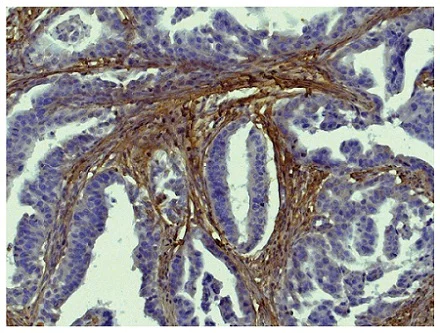 Immunohistochemistry (Formalin/PFA-fixed paraffin-embedded sections) - Biotin Anti-Collagen I antibody (AB24821)