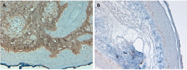 Immunohistochemistry (Formalin/PFA-fixed paraffin-embedded sections) - Biotin Anti-Collagen I antibody (AB6577), expandable thumbnail