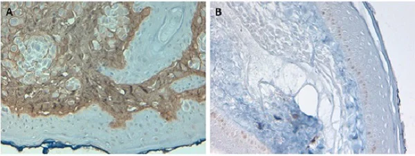 Immunohistochemistry (Formalin/PFA-fixed paraffin-embedded sections) - Biotin Anti-Collagen I antibody (AB6577)