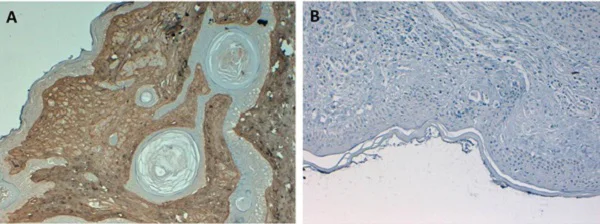 Immunohistochemistry (Formalin/PFA-fixed paraffin-embedded sections) - Biotin Anti-Collagen I antibody (AB6577)