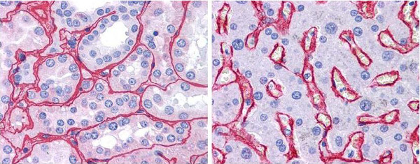 Immunohistochemistry (Formalin/PFA-fixed paraffin-embedded sections) - Biotin Anti-Collagen IV antibody (AB6581), expandable thumbnail