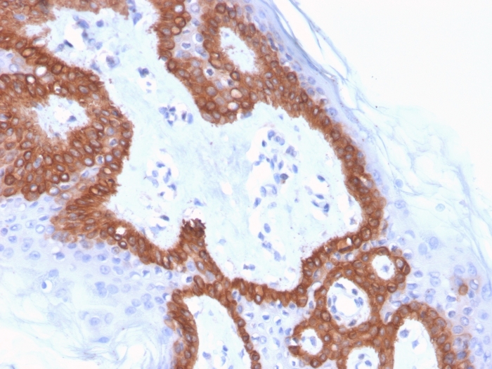 Immunohistochemistry (Formalin/PFA-fixed paraffin-embedded sections) - Biotin Anti-Cytokeratin 14 antibody [LL002] (AB271819), expandable thumbnail