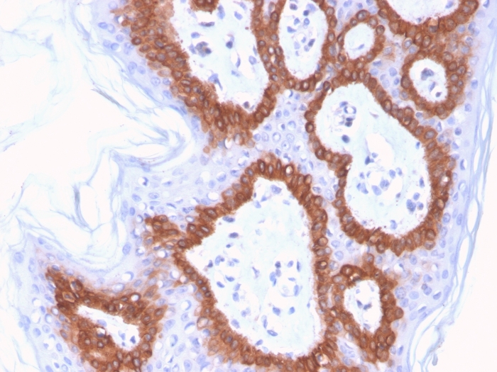 Immunohistochemistry (Formalin/PFA-fixed paraffin-embedded sections) - Biotin Anti-Cytokeratin 14 antibody [LL002] (AB271819), expandable thumbnail