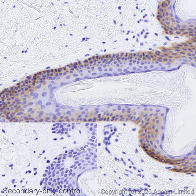 Immunohistochemistry (Formalin/PFA-fixed paraffin-embedded sections) - Biotin Anti-Cytokeratin 14 antibody [SP53] (AB323529)