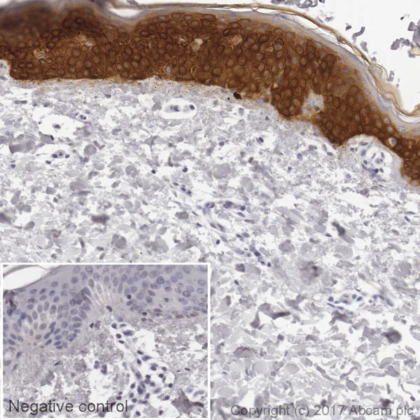 Immunohistochemistry (Formalin/PFA-fixed paraffin-embedded sections) - Biotin Anti-Cytokeratin 17 antibody [EP1623] - Cytoskeleton Marker (AB195906)