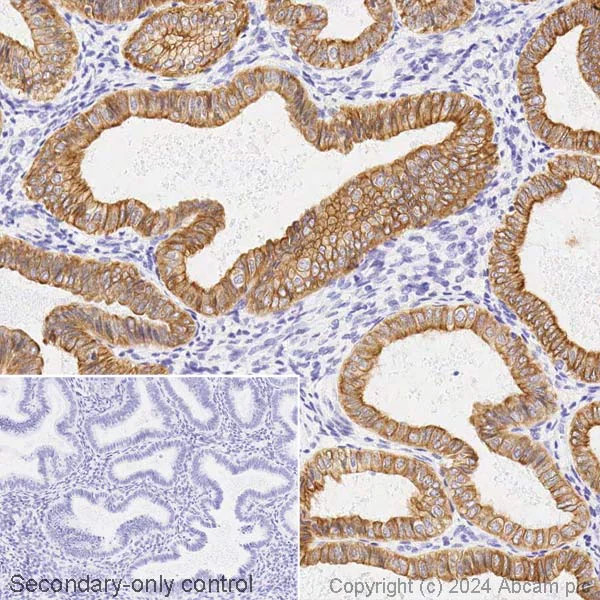 Immunohistochemistry (Formalin/PFA-fixed paraffin-embedded sections) - Biotin Anti-Cytokeratin 18 antibody [SP69] (AB317078)