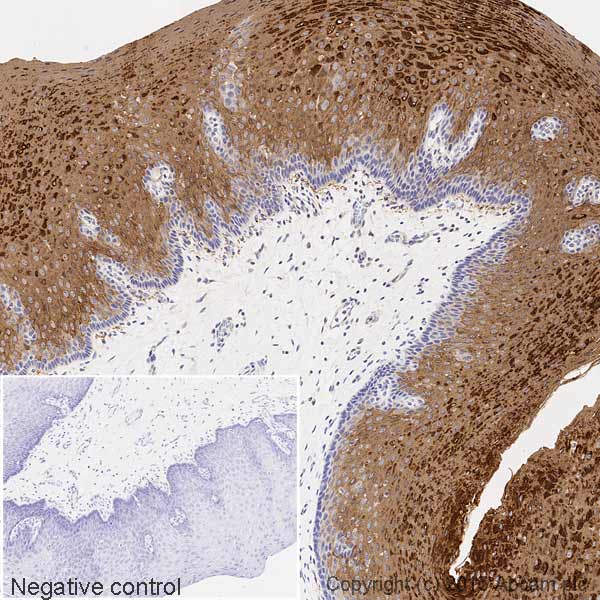 Immunohistochemistry (Formalin/PFA-fixed paraffin-embedded sections) - Biotin Anti-Cytokeratin 4 antibody [EP1599Y] (AB200001), expandable thumbnail