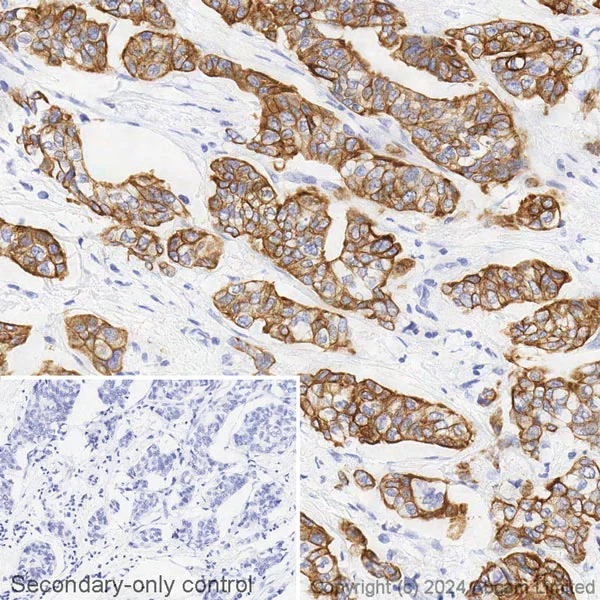 Immunohistochemistry (Formalin/PFA-fixed paraffin-embedded sections) - Biotin Anti-Cytokeratin 8 antibody [SP102] - C-terminal (AB322309)
