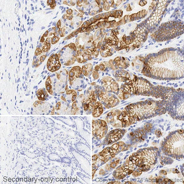 Immunohistochemistry (Formalin/PFA-fixed paraffin-embedded sections) - Biotin Anti-Cytokeratin 8 antibody [SP102] - C-terminal (AB322309)