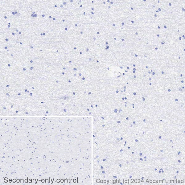 Immunohistochemistry (Formalin/PFA-fixed paraffin-embedded sections) - Biotin Anti-Cytokeratin 8 antibody [SP102] - C-terminal (AB322309), expandable thumbnail