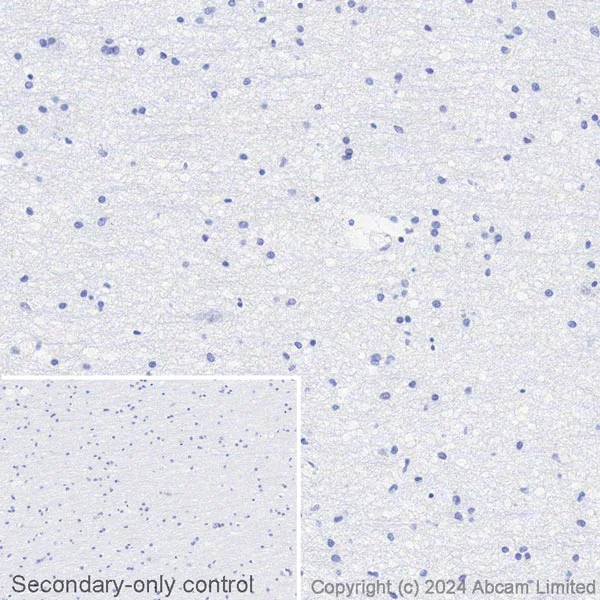 Immunohistochemistry (Formalin/PFA-fixed paraffin-embedded sections) - Biotin Anti-Cytokeratin 8 antibody [SP102] - C-terminal (AB322309)