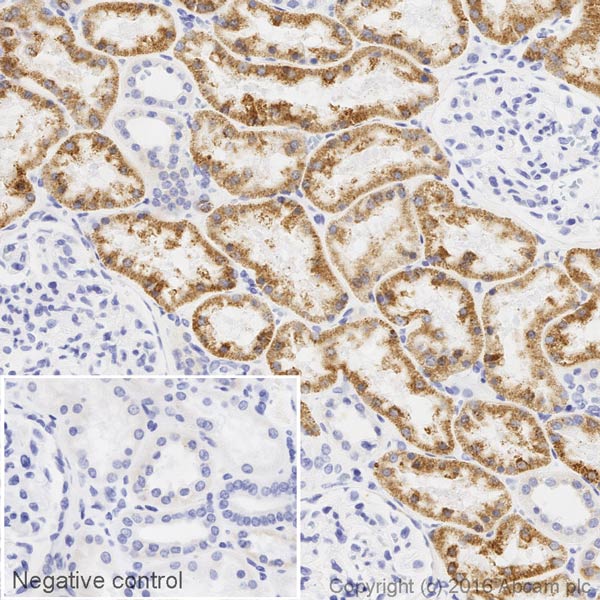 Immunohistochemistry (Formalin/PFA-fixed paraffin-embedded sections) - Biotin Anti-DARC antibody [EPR5205] (AB199770)