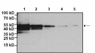Western blot - Biotin Anti-DDDDK tag (Binds to FLAG® tag sequence) antibody [FG4R] (AB173832), expandable thumbnail