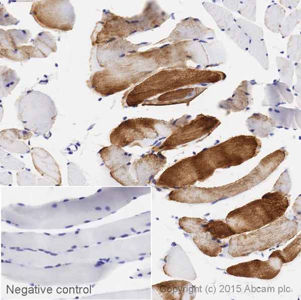 Immunohistochemistry (Formalin/PFA-fixed paraffin-embedded sections) - Biotin Anti-Desmin antibody [Y66] - Cytoskeleton Marker (AB197603)