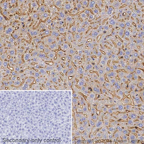 Immunohistochemistry (Formalin/PFA-fixed paraffin-embedded sections) - Biotin Anti-DPP4 antibody [EPR18215] (AB317766), expandable thumbnail