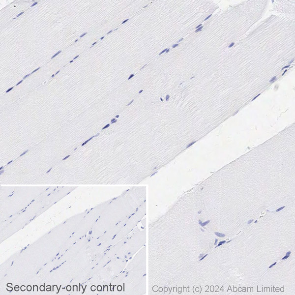 Immunohistochemistry (Formalin/PFA-fixed paraffin-embedded sections) - Biotin Anti-DPP4 antibody [EPR18215] (AB317766), expandable thumbnail