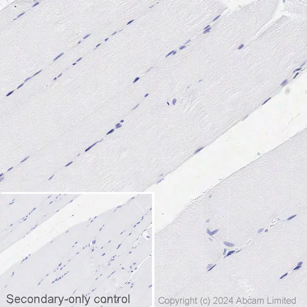 Immunohistochemistry (Formalin/PFA-fixed paraffin-embedded sections) - Biotin Anti-DPP4 antibody [EPR18215] (AB317766)