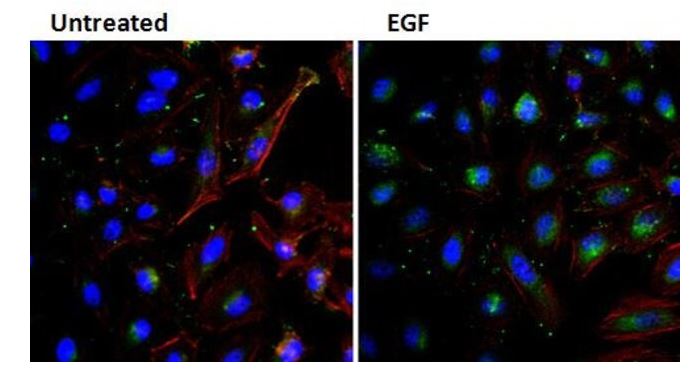 Immunocytochemistry - Biotin Anti-EGF antibody [3A8] (AB155576)