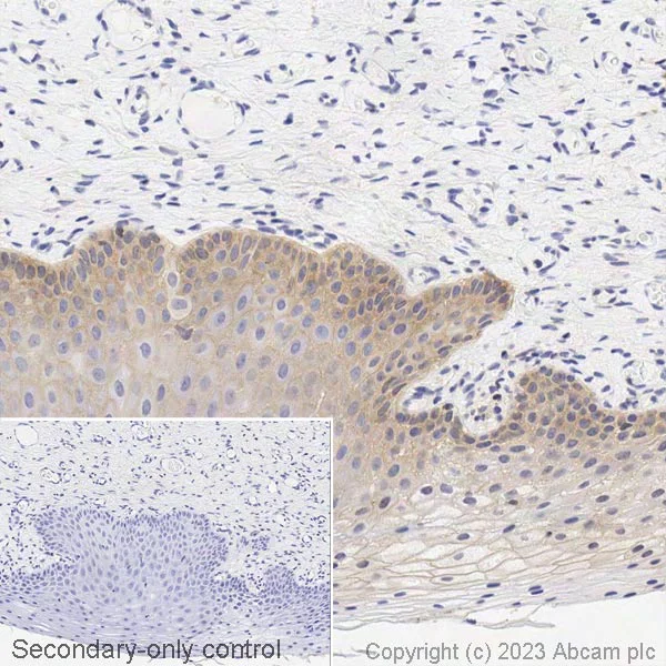 Immunohistochemistry (Formalin/PFA-fixed paraffin-embedded sections) - Biotin Anti-EGFR antibody [E235] (AB314263)