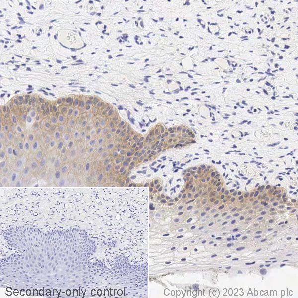Immunohistochemistry (Formalin/PFA-fixed paraffin-embedded sections) - Biotin Anti-EGFR antibody [EP38Y] (AB314262)